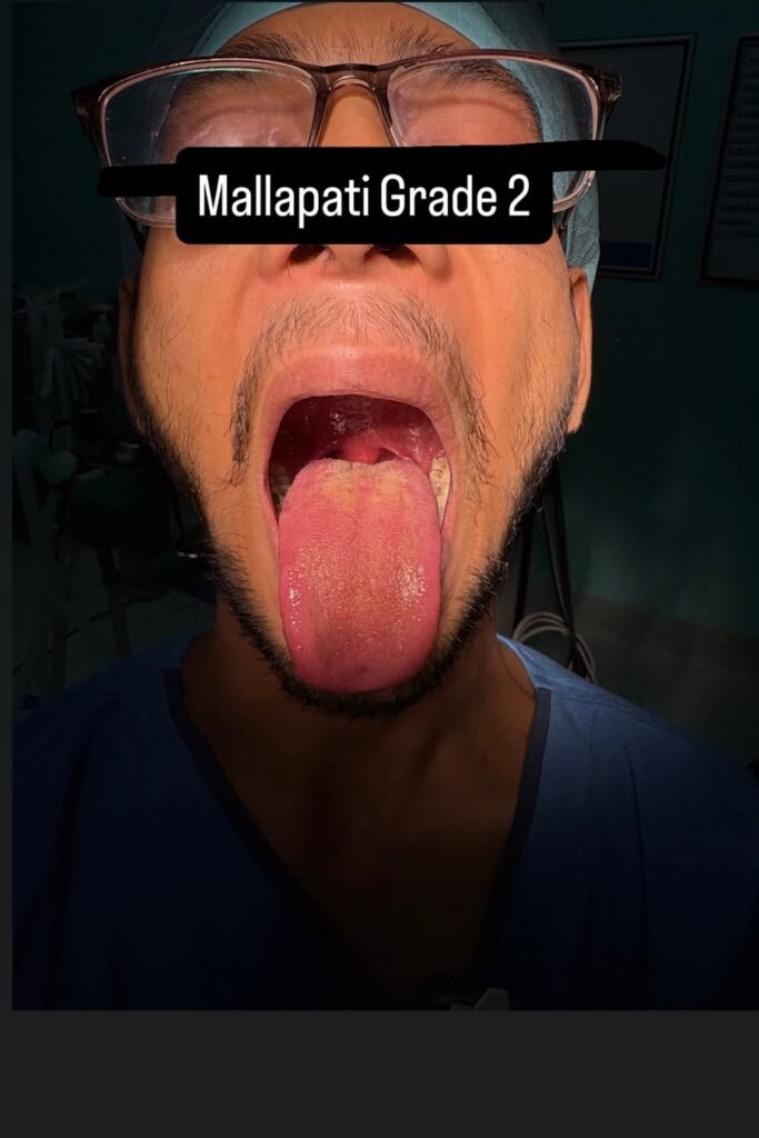 mallampati classification