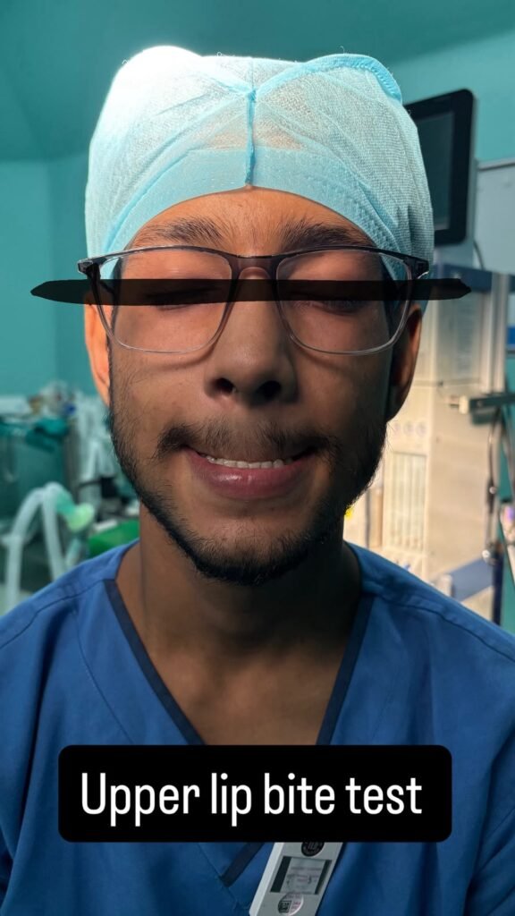 upper lip bite test